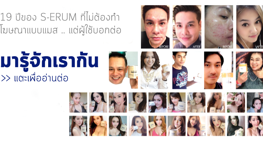 ความเป็นมาของ S-ERUM