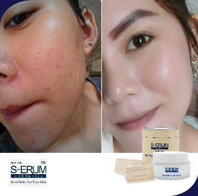 รีวิวจากผู้ใช้ S-ERUM ทั่วประเทศ 39.jpg